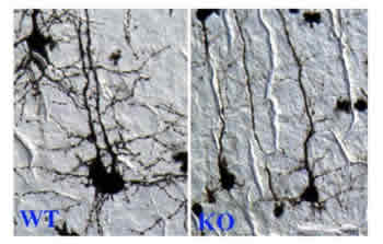 Images of neurons from normal mice (left) and from mice lacking CREST gene (right) 