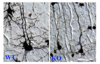 Images of neurons from normal mice (left) and from mice lacking CREST gene (right)